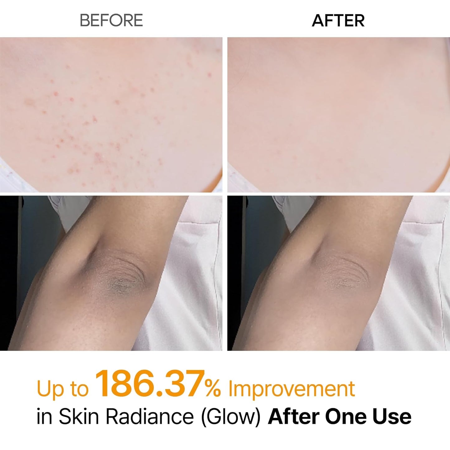 The Professional Body Resurfacing Mist